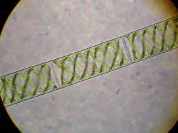 Spirogyra bereproduksi secara aseksual dengan cara fragmentasi dan secara seksual dengan konjugasi. Spirogyra Wikipedia Bahasa Indonesia Ensiklopedia Bebas