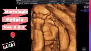 Afla cand se fac acestea si ce presupun ele. Ce Trebuie Sa Stii Despre Morfologia Fetala Ecografie Morfologica Trimestru 2 Si 3 Evrabie Youtube