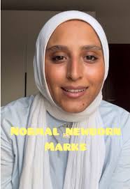 Understanding Normal Newborn Marks: A New Mom's Guide