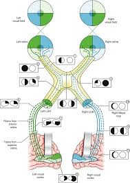 Image result for Visual Field Deficit