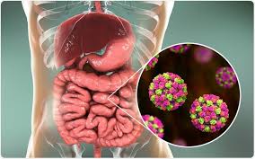 This is called acute gastroenteritis. Trasmissione Di Norovirus