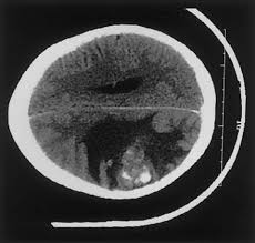 In time you'll find ways to cope with your feelings, but in the. Solid Tumors In Children Journal Of Pediatric Nursing Nursing Care Of Children And Families