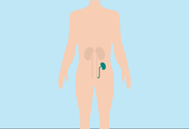 I will start with types of bahasa melayu that we have and we will later on progress further… Therapy Options Other Renal Treatment Options Baxter