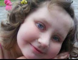 Hi looking for some advice first , has anyone put hair in resin, I have all  my daughter's hair that fell out when she had chemo how is the best way to