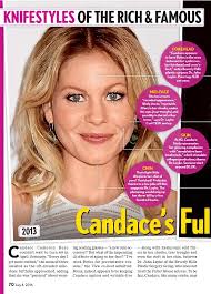 Candace's Fuller Face