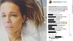 A cyst that ruptures may cause no symptoms, or only mild some ruptured ovarian cysts can cause a lot of bleeding. Kate Beckinsale Hospitalized With Ruptured Ovarian Cyst Cnn