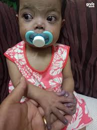 Her Oxygen Level Is Only 74, Please Save Humaira