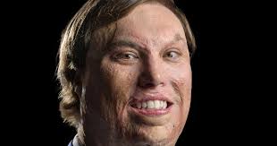 Unstoppable: How Connor McKemey Of MAC Mentality Has Redefined Success  While Navigating Society With Severe Burns