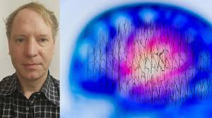 Sjukdom spåras med extrem förstoring