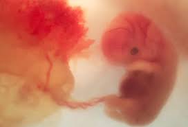 I'm prone to mc's so carried on testing, i'm now 11 weeks. First Trimester 4 Weeks Picture Image On Medicinenet Com
