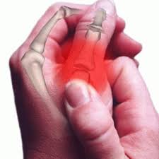 L'arthrite est une maladie inflammatoire qui touche les articulations et les os. Articulation Du Coude Raide Apres L Entrainement Biosanga Fr