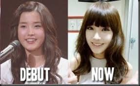 Beredar sejumlah foto yang diklaim netizen membuktikan suzy melakukan operasi plastik. 15 Artis Korea Yang Melakukan Operasi Plastik Kaskus