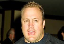 Kevin James' Hair Transplant