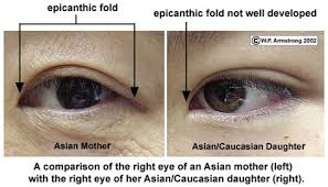 There are clinical terms ― like the epicanthal folds. Epicanthal Folds Vs Normal Drone Fest