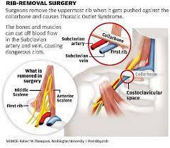 Ribs Lost Careers Saved Wusm Surgeon Gets Athletes Back On The Field The Source Washington University In St Louis
