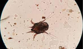 Ear Mites In Cats Petcoach