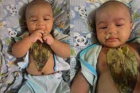 Selamat memasuki pengalaman baru yang menakjubkan ini! Bayi Batuk Pilek Tak Perlu Obat Kimia Cukup Selembar Daun Sirih Tempel Di Badannya Ga Lama Dahak Keluar Dari Hidungnya