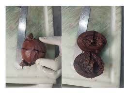 Image result for Retained Placenta