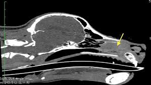 The most common sites for metastasis are the lymph nodes and the lungs, but can also include other organs. As Nasal Tumor Cases Grow So Do Options