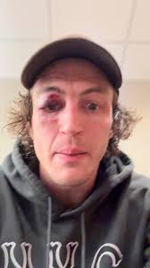 Left it all out there. Thank you to everybody over the years. Just don’t  have it like I used to. Time to focus