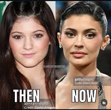 Sza was gorgeous before....