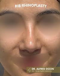 Dr. Alfred Dizon (@dizonent) • Instagram photos and videos