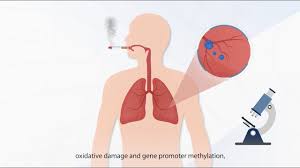 However, it is important to bear in mind that they are not always that specific. The Important Tumor Markers You Must Know About Lung Cancer Youtube
