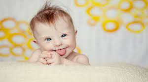 Ibu perlu mengenal beberapa cara menggendong bayi sebab cara menggendong ini dapat berpengaruh pada tumbuh kembangnya. Kenali Ini 15 Ciri Bayi Down Syndrome