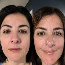 SUCK Prep 2025. Big Ryan Bergman of Travis Kane's Carthage Mafia has been  carrying a 50lb pack while doing the farm chores in the frigid cold. He  doesn't ride that tractor btw,