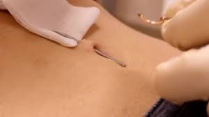 Some woman's bely button was being pushed by a needle. Parity Navel Needle Up To 62 Off