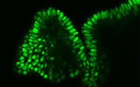 Stem cells are the future of modern medicine with the potential to manage a variety of lifestyles and chronic diseases. Uciv2cuk6fmbxm