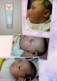 Business service (transportation, finance, travel, ads, etc). Eczema