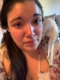 Broken blood feather in a young bird