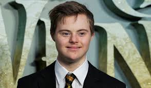 World Down Syndrome Day: Remember the Value of Every Life