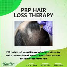 Hair loss treatment (eclipse prp). Hairfree Laser Skin Clinics Posts Facebook