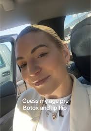 Guess My Age: Botox and Lip Flip Transformation