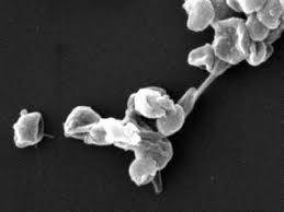 Image result for Neoschumannia