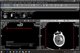 blog how ai could make radiologists jobs less stressful