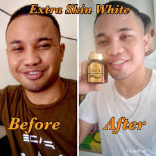 Achieve healthy skin by choosing from the large selection of extra skin cream on alibaba.com. Diduakan Isteri Hanya Kerana Kulit Gelap Dan Kusam Idham