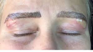 Kalamazoo Woman Says She Received Botched Microblading Salon Owner Defends Work Wwmt Professionals are welcome to discuss tools, techniques, schools, and other specifics of the trade.