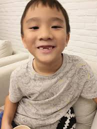 Jules, James & Jade: Jules // 2 Front Teeth