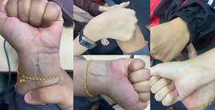 Join facebook to connect with maksud swarnam maksud swarnam and others you may know. Kulit Cerah Sampai Nampak Urat Hijau Benarkah Ia Petanda Kematian Mengejut Kisah Dunia