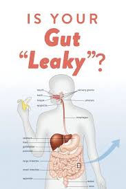 What Is A Leaky Gut And How Can It Cause So Many Health Issues Leaky Gut Diet Leaky Gut Symptoms Leaky Gut