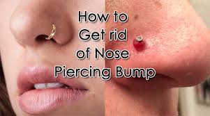 How To Get Rid Of Nose Piercing Bump Nose Piercing In 2020 Nose Piercing Bump Piercing Bump Nose Piercing
