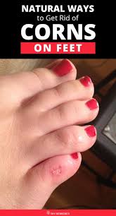 Pin On Treat Plantar Fasciitis
