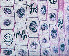 Each question is multiple choice, but if you were to put down your microscope and biochemically study what's happening during interphase, you'd in plant cells, the golgi complex sends vesicles filled with cellulose (at 1) to the cell equator. 21 Microscope Stuffs Ideas Microscope Mitosis Cell Cycle