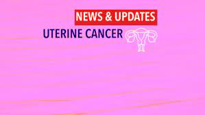 It may also be used before surgery so as to reduce. Study Supports Laparoscopy For Uterine Cancer Cancerconnect