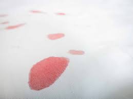 Blutflecken aus einer matratze entfernen kann sich als recht schwierig erweisen. Blutflecken Entfernen Die Besten Tipps Und Tricks Meistersauber