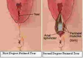 Hal inilah yang menjadi sebab orang lebih banyak hapal nomor pin daripada rekeningnya sendiri. Cara Mudah Bersalin Tanpa Koyakan Yang Perlu Diketahui Bakal Ibu Theasianparent Malaysia