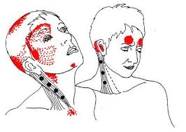 Pin On Jaw Neck Head Pain